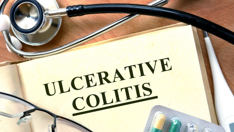 Ulcerative Colitis (ABI-M201-101)